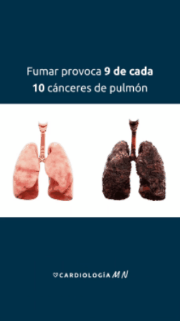 10 Unidad de Paches Antitabaco